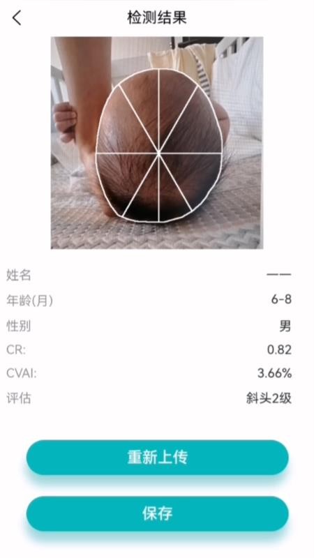 StarBaby头形分析APP软件最新版下载