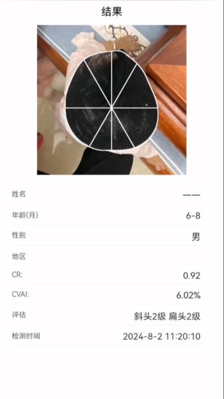 StarBaby头形分析APP软件最新版下载